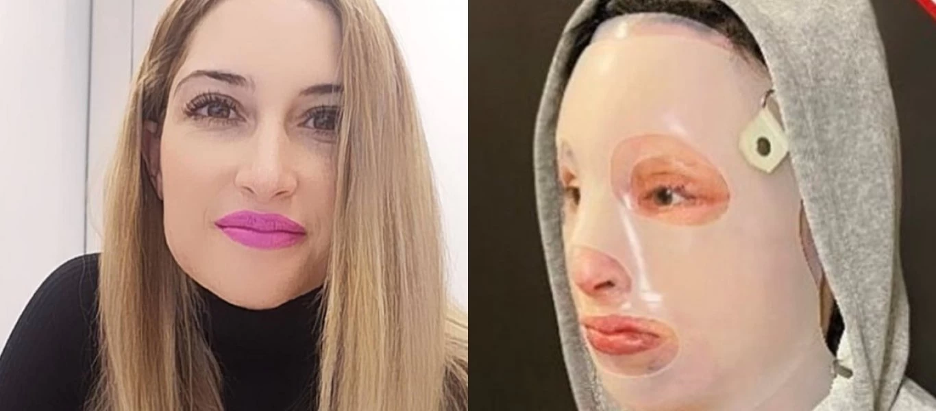 Επίθεση με βιτριόλι - Ιωάννα: «Επίπονο... αλλά θα πάω στο δικαστήριο»